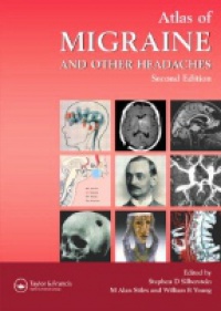 Silberstein S. D. - Atlas of Migraine and Other Headaches