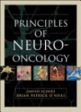 Principles of Neurooncology
