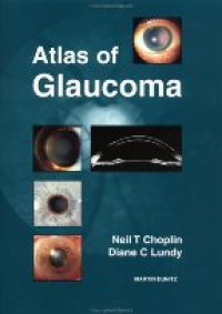 Choplin N. - Atlas of Glaucoma
