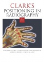 Clark´s Positioning in Radiography