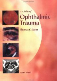 Spoor T. - An Atlas of Ophthalmic Trauma