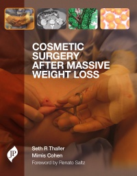 Seth Thaller - Cosmetic Surgery After Massive Weight Loss