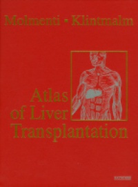 Molmenti - Atlas of Liver Transplantation