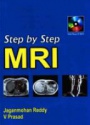 Step by Step MRI