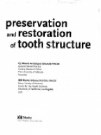 Mount G. J. - Preservation and Restroration of Tooth Structure