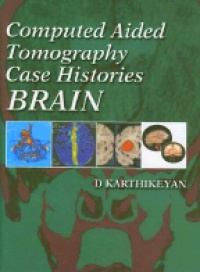 Karthikeyan D. - Computed Aided Tomography Case Histories Brain