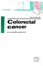 Colorectal Cancer: A Scientific Perspective