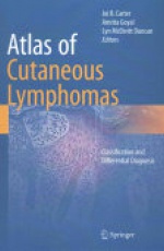 Atlas of Cutaneous Lymphomas