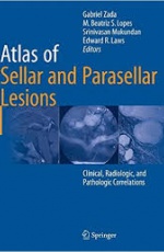 Atlas of Sellar and Parasellar Lesions