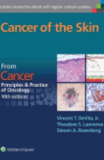 Cancer of the Skin: Cancer:  Principles & Practice of Oncology, 10th edition