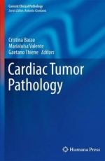Cardiac Tumor Pathology