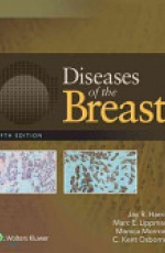 Diseases of the Breast 5e