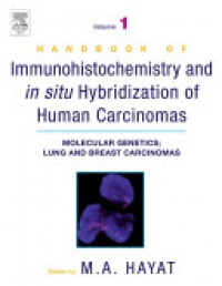 Hayat, M. A. - Handbook of Immunohistochemistry and in Situ Hybridization of Human Carcinomas