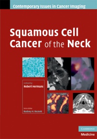 Hermans R. - Squamous Cell Cancer of the Neck