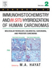 Hayat, M. A. - Handbook of Immunohistochemistry and in Situ Hybridization of Human Carcinomas