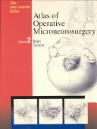 Tew, John M. - Atlas of Operative Microneurosurgery, Volume 2