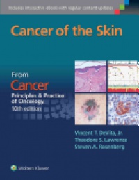 Vincent T DeVita ,Theodore S. Lawrence,Steven A. Rosenberg - Cancer of the Skin: Cancer:  Principles & Practice of Oncology, 10th edition