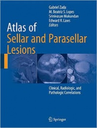 Zada - Atlas of Sellar and Parasellar Lesions