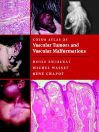 Enjolras O. - Color Atlas of Vascular Tumors and Vascular Malformations