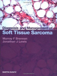 Murray Brennan,Jonathan Lewis - Diagnosis and Management of Soft Tissue Sarcoma