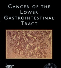 Christopher G. Willett - Cancer of the Lower Gastrointestinal Tract