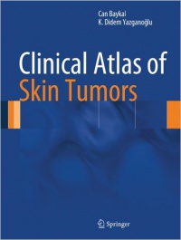 Baykal - Clinical Atlas of Skin Tumors