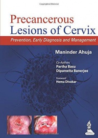Maninder Ahuja - Precancerous Lesions of Cervix: Prevention, Early Diagnosis and Management