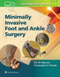 Christopher Chiodo,Eric Bluman - Minimally Invasive Foot & Ankle Surgery