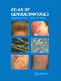 Caputo R. - Atlas of Genodermatoses