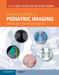Heike E. Daldrup-Link,Beverley Newman - Pearls and Pitfalls in Pediatric Imaging: Variants and Other Difficult Diagnoses