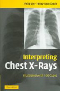 Eng P. - Interpreting Chest X-rays: Illustrated with 100 Cases