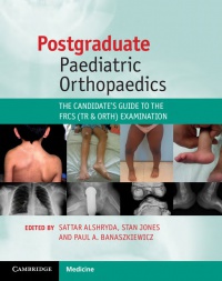 Sattar Alshryda,Stan Jones,Paul A. Banaszkiewicz - Postgraduate Paediatric Orthopaedics: The Candidate's Guide to the FRCS (Tr and Orth) Examination