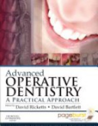 Ricketts D. - Advanced Operative Dentistry