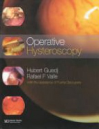 Guedj H. - Operative Hysteroscopy