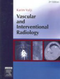 Valji, Karim - Vascular and Interventional Radiology