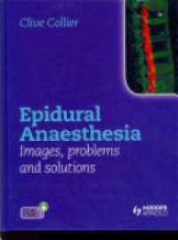 Collier C. - Epidural Anaesthesia: Images, Problems and Solutions