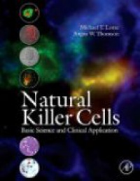Michael T. Lotze - Natural Killer Cells