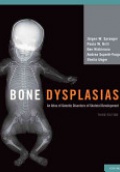 Bone Dysplasias 
