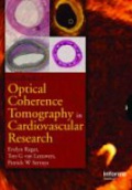 Optical Coherence Tomography in Cardiovascular Research