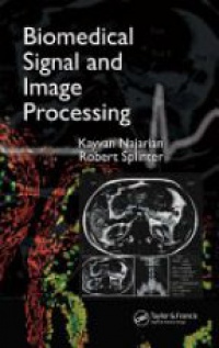Najarian K. - Biomedical Signal and Image Processing