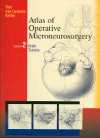Tew J.M. - Atlas of Operative Microneurosurgery