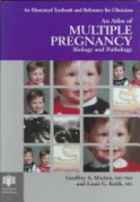 G.A. Machin,Louis G. Keith - An Atlas of Multiple Pregnancy: Biology and Pathology