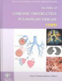 Hansel T. T. - An Atlas of Chronic Obstructive Pulmonary Disease 
