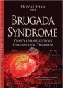 Brugada Syndrome: Clinical Manifestations, Diagnosis & Treatment