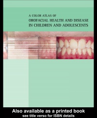Crispian Scully,Richard Welbury,Catherine Flaitz,Oslei Paes de Almeida - Color Atlas of Orofacial Health and Disease in Children and Adolescents