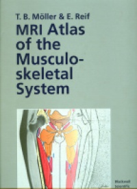 Moller T.B. - MRI Atlas of the Musculoskeletal System