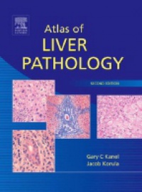 Kanel G. C. - Atlas of Liver Pathology