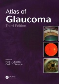 Atlas of Glaucoma