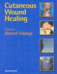 Falanga V. - Cutaneous Wound Healing
