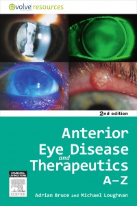 Bruce, Adrian S. - Anterior Eye Disease and Therapeutics A-Z